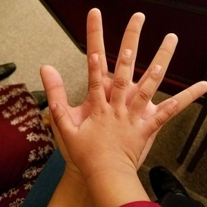 Meet your Posher, Bugalo